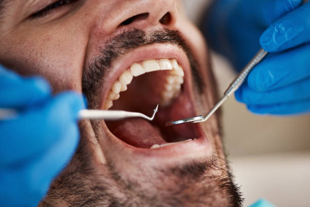Best Emergency Gum Pain Relief  in Pemberville, OH
