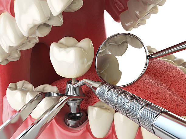 Best Root Canal Emergency Dentist  in Pemberville, OH